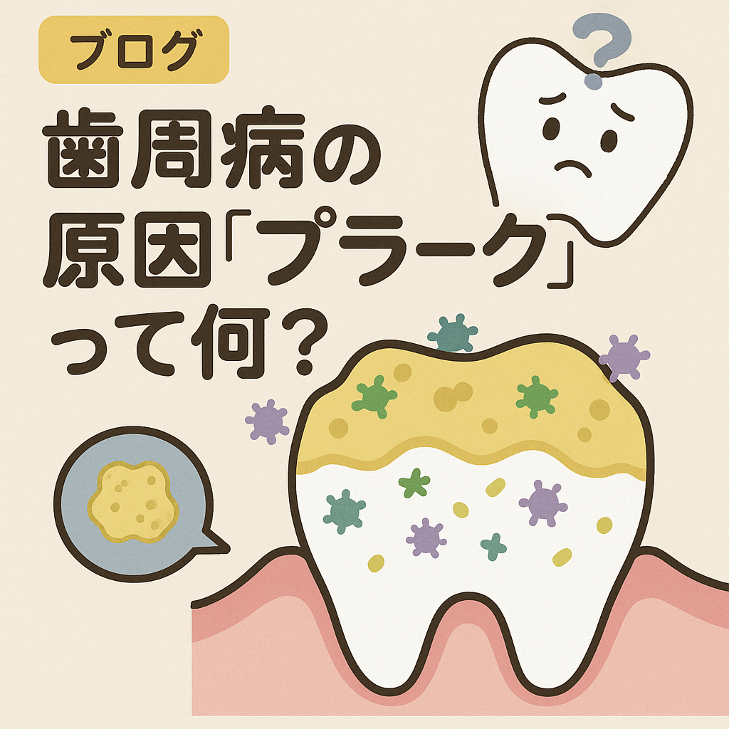 【 ブログ 】歯周病の原因「プラーク」って何？🦷